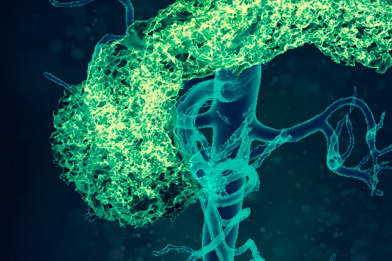 心血管與新陳代謝疾病